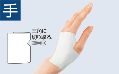 腱鞘炎におすすめの湿布の種類と選び方