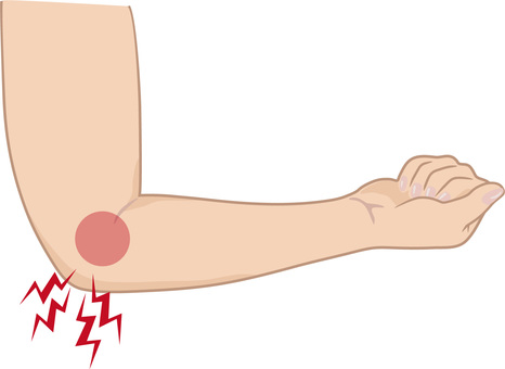 肘を押すと痛いのはなぜ?痛む仕組みをわかりやすく解説