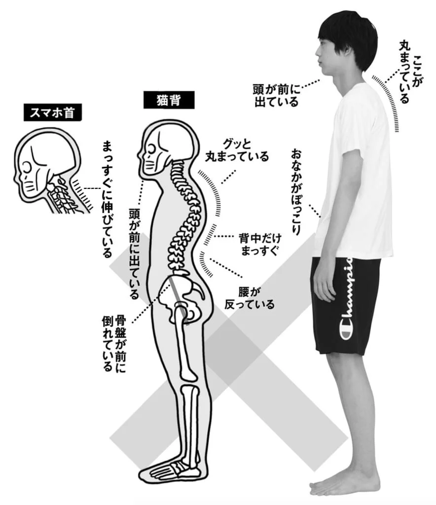 首バキバキが鳴る主な原因|生活習慣・姿勢・体の状態