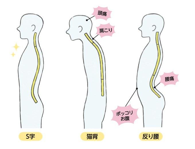肩が重い状態を放置するとどうなる?