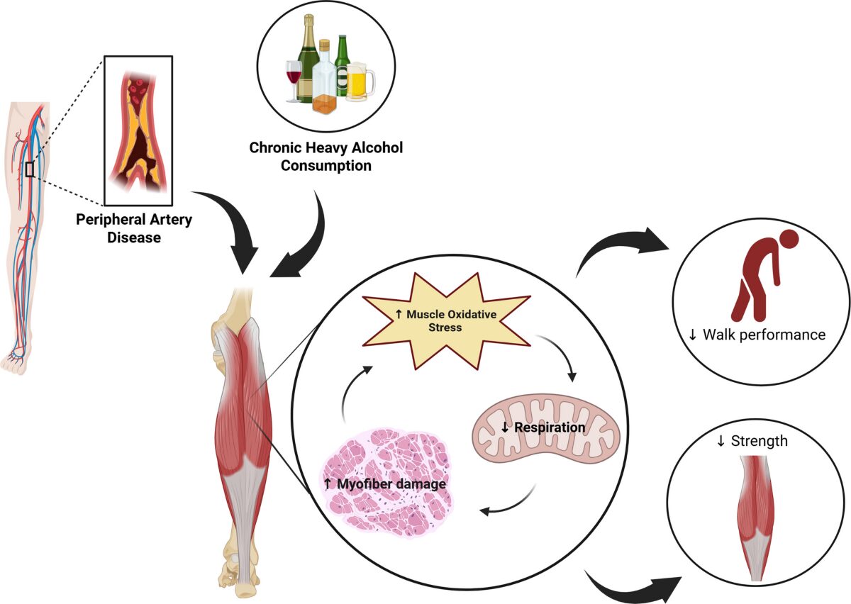アルコール筋症で寝れないときの対処法