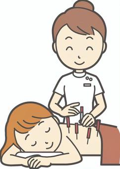 鍼灸 イラストとは?検索ニーズと使い方