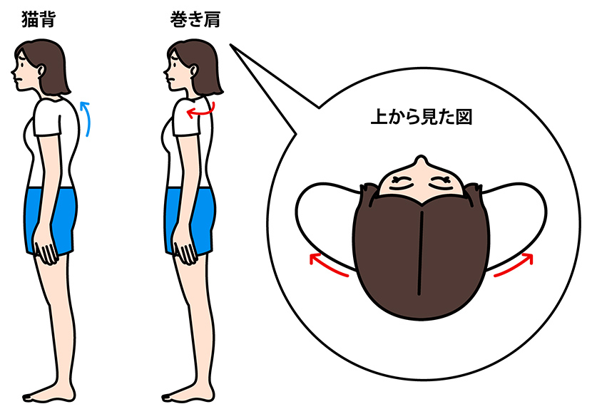 脇の下がつる原因になりやすい生活習慣