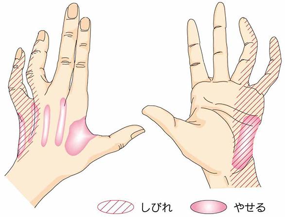 四十肩で病院に行くべきか?来院の判断基準
