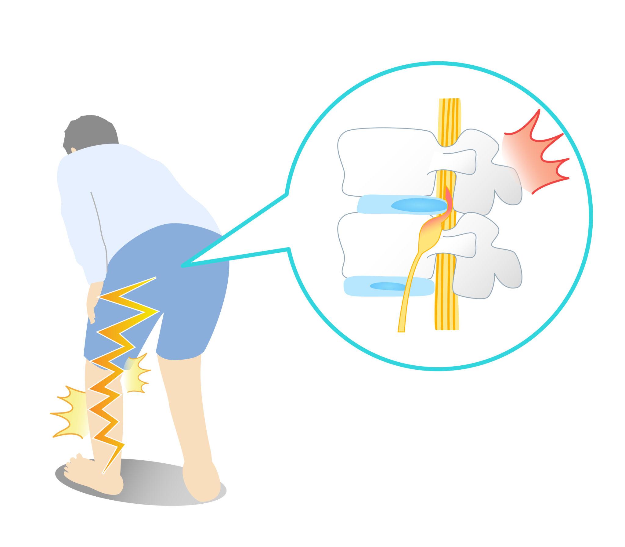 足の小指の感覚がないときに考えられる病気