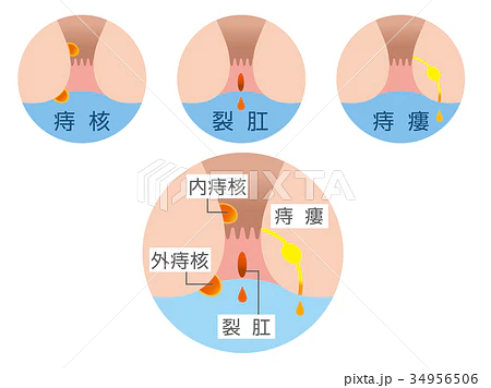 痛みの種類でわかる原因の見分け方