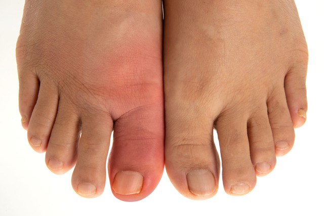 足 親指 痛みの主な原因(病名別)