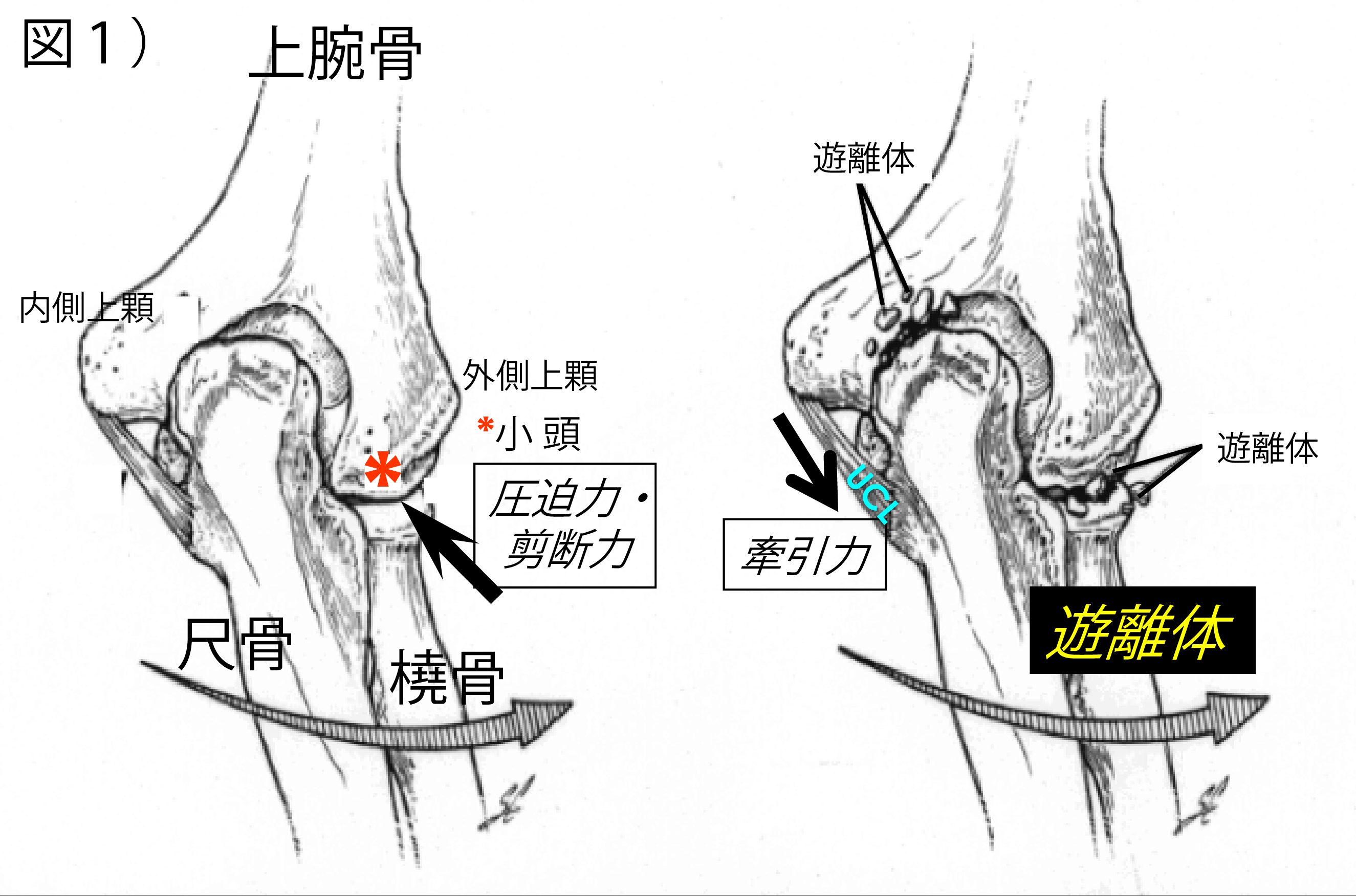 部位別に考える原因一覧(内側・外側・後ろ・全体)