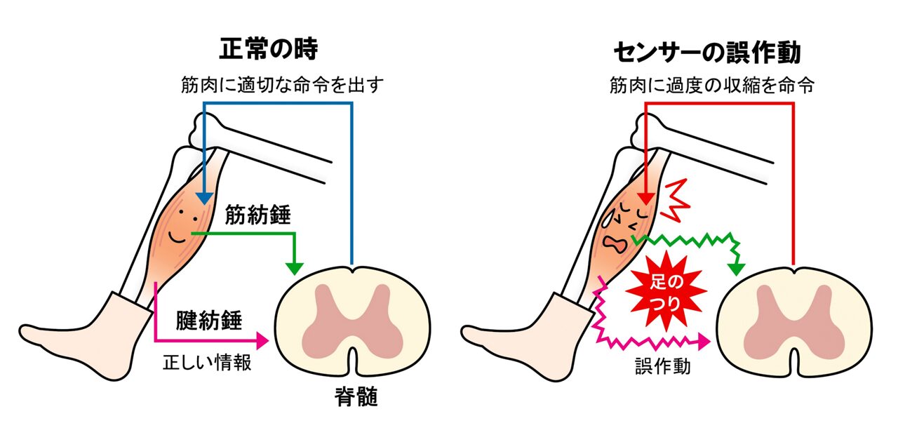 病院に行くべきすねのつりとは?(受診の目安)