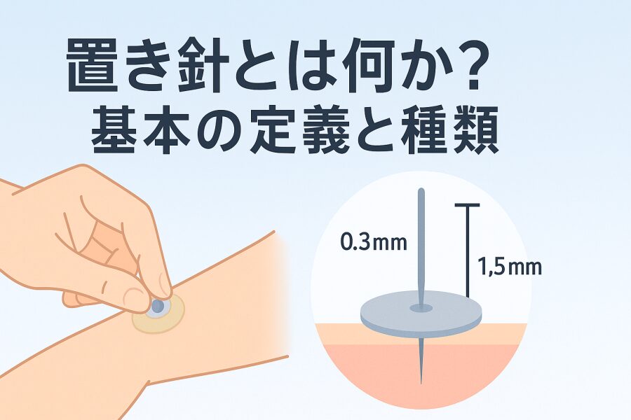 針シールの選び方とおすすめタイプ比較
