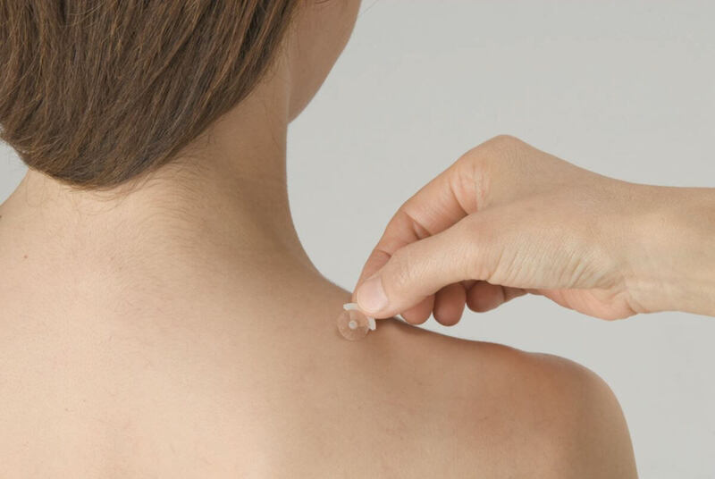 肩こり 針 シール(円皮鍼)とは?基本の仕組みと効果