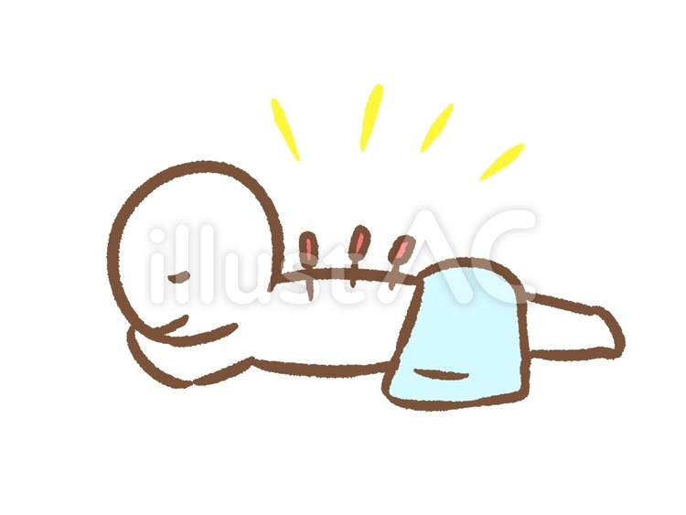 鍼灸イラストの描き方・アレンジ(初心者向け)