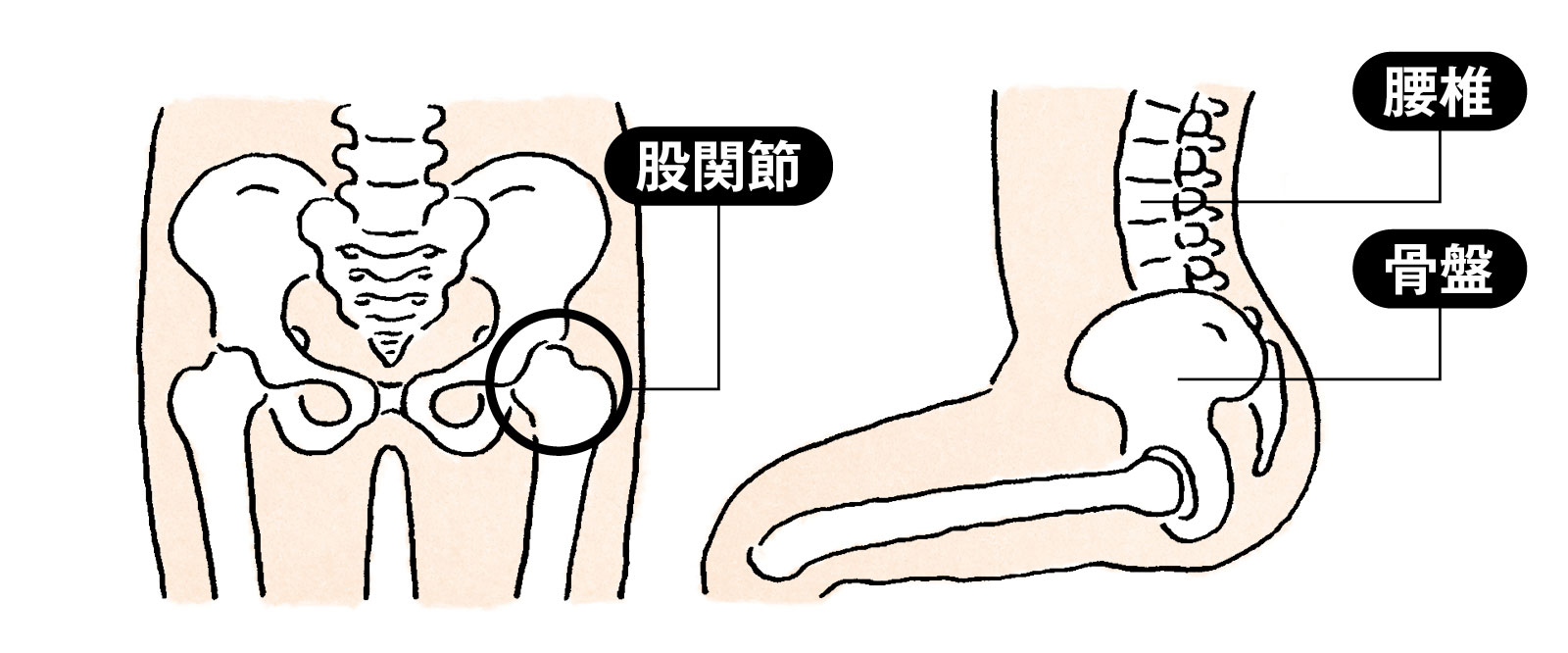 左臀部 痛みの主な原因とは?