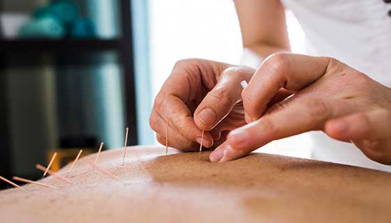 鍼灸の医療費控除でよくある疑問(FAQ)