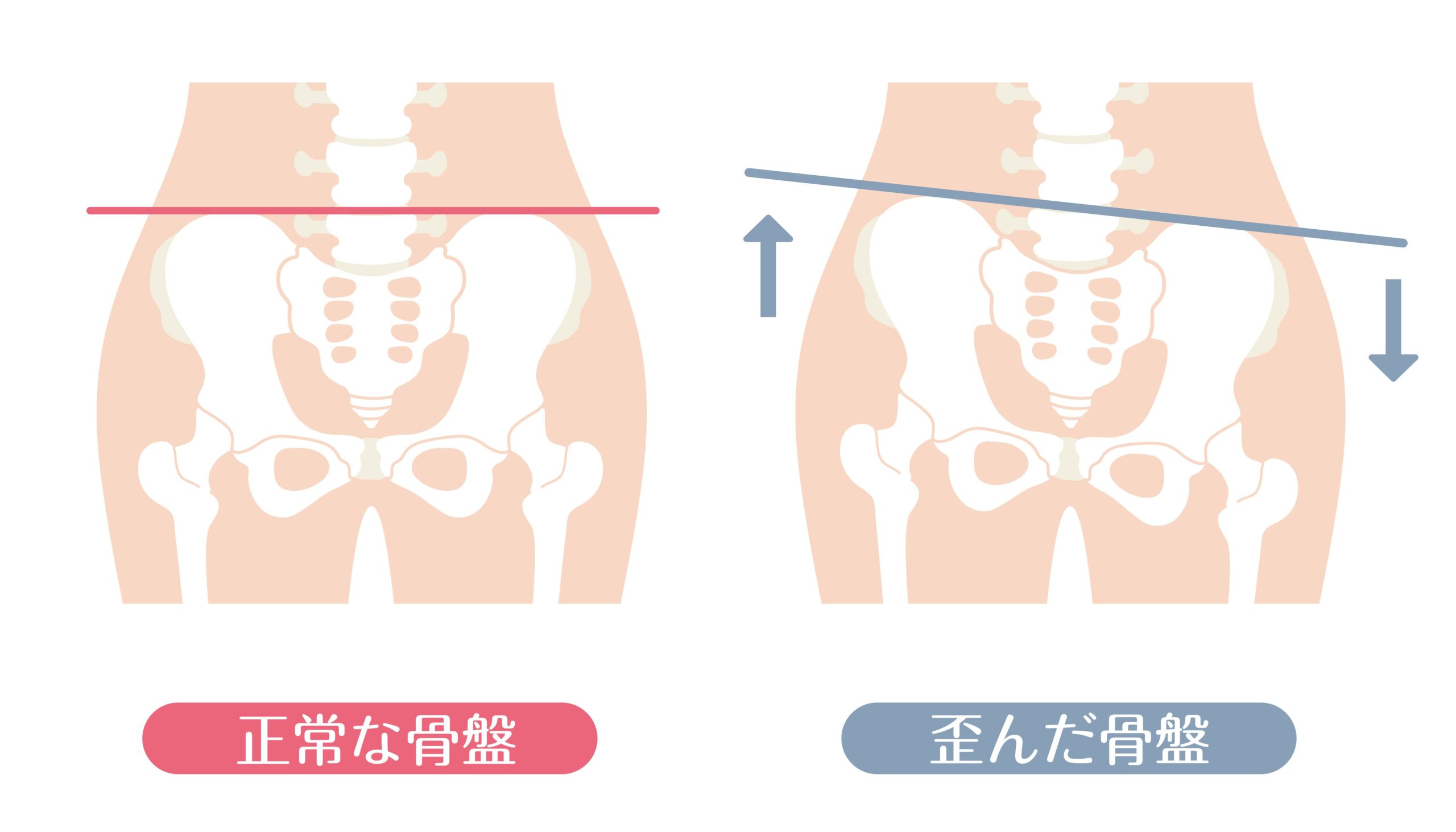 右股関節痛の原因:日常習慣〜疾患まで