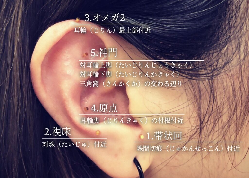 鍼灸検査の流れ・施術例(初心者向け)