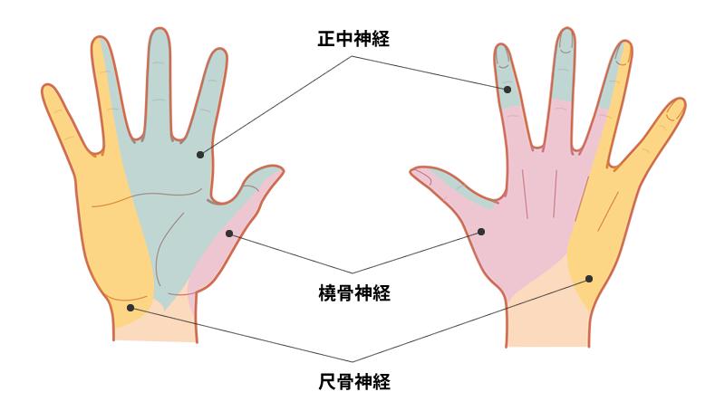 手のひらが痛いのはなぜ?よくある症状と特徴