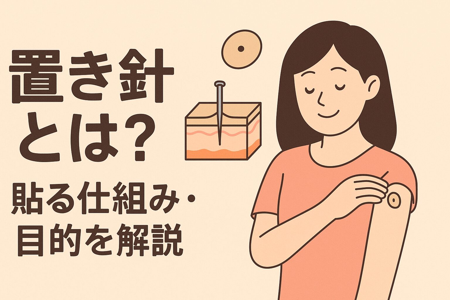 置き針とは?貼る仕組み・目的を解説