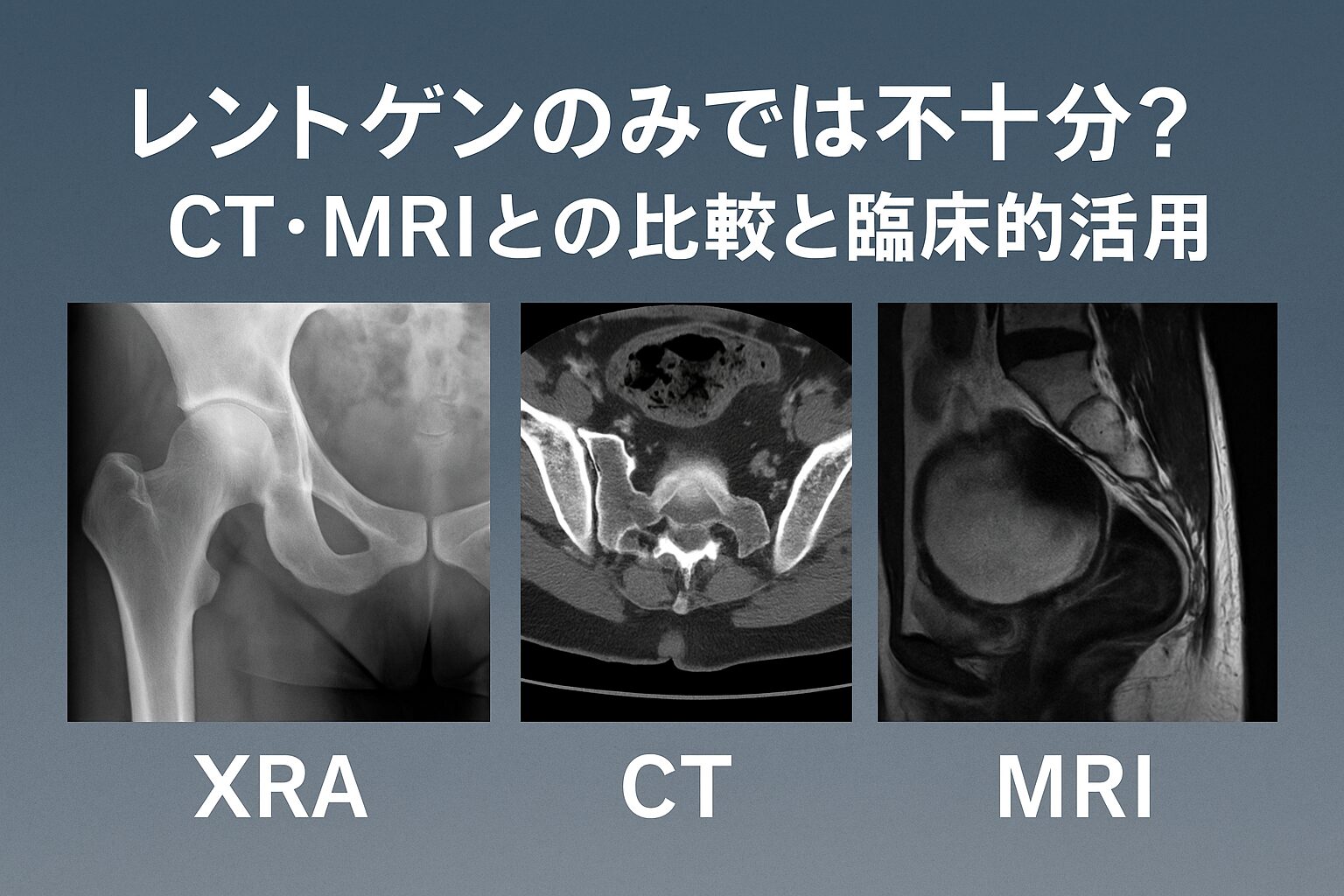 レントゲンのみでは不十分？CT・MRIとの比較と臨床的活用