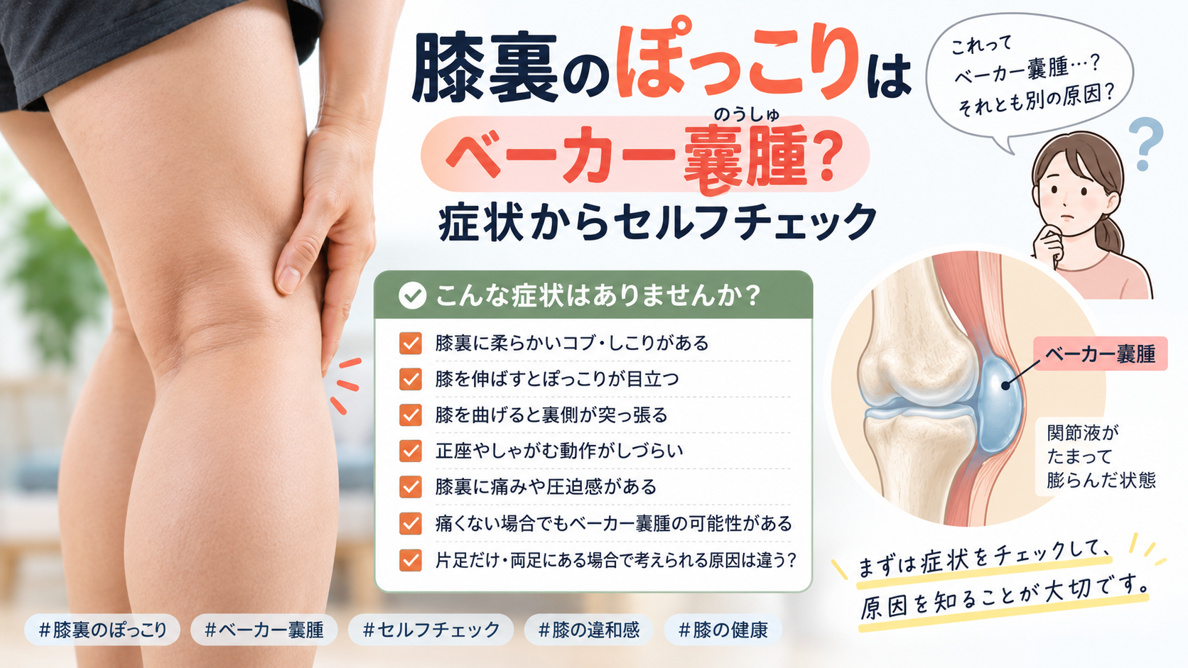 膝裏のぽっこりはベーカー嚢腫?症状からセルフチェック