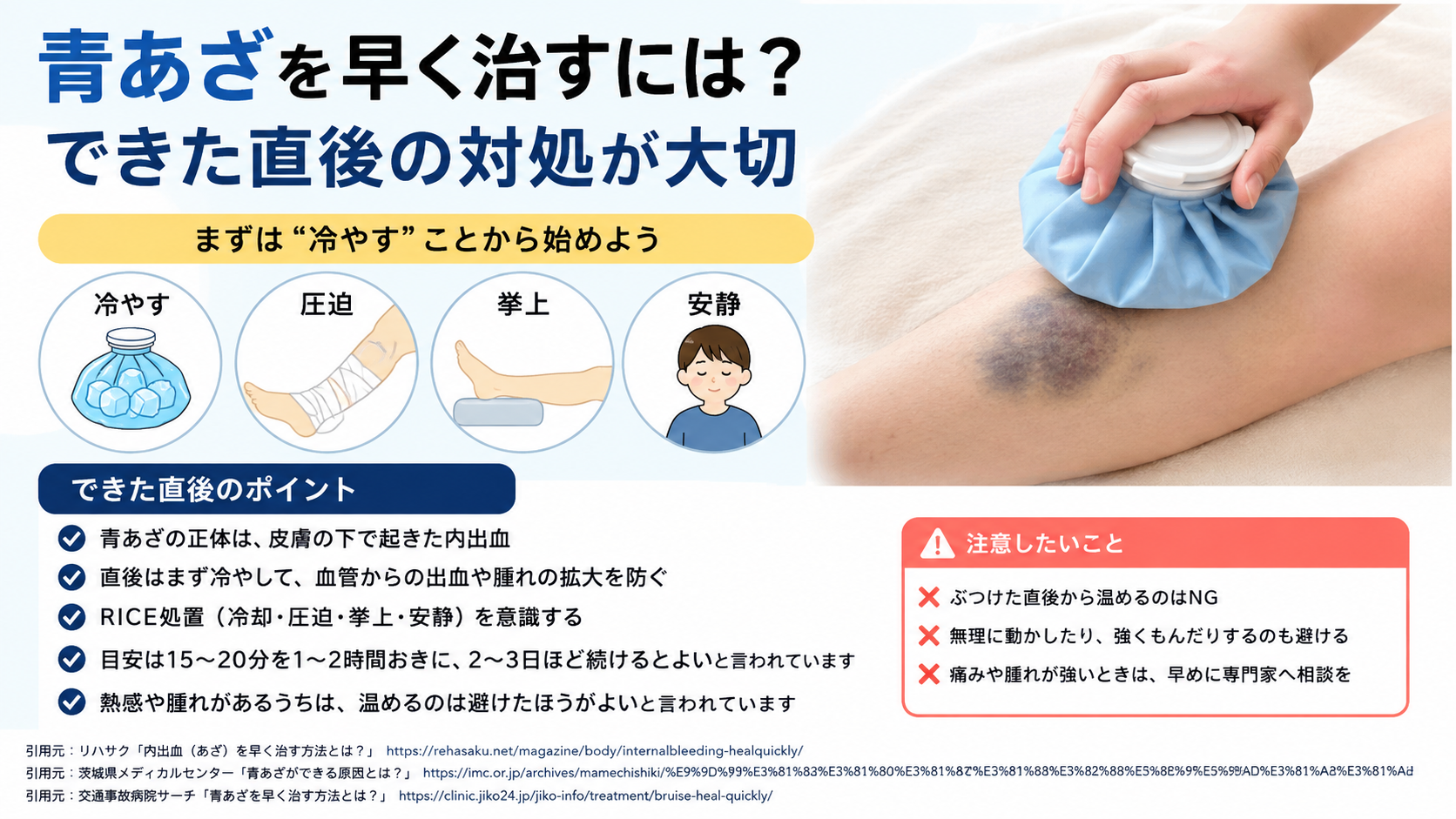 青あざを早く治すには?できた直後の対処が大切