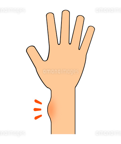 なぜ「手首が太く見える/太くなる」のか?