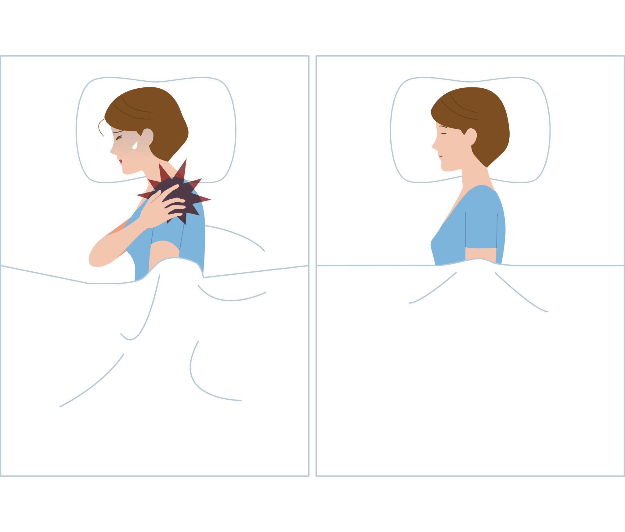 六十肩の症状と進行段階
