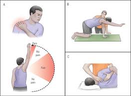 整骨院・整体で行われる肩甲骨周辺のケア