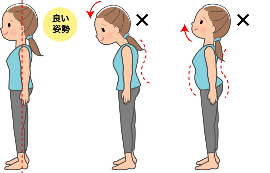 ヘルニアになりやすい人の特徴