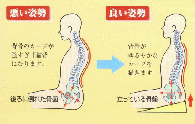 猫背が改善しない原因と見落としがちなポイント