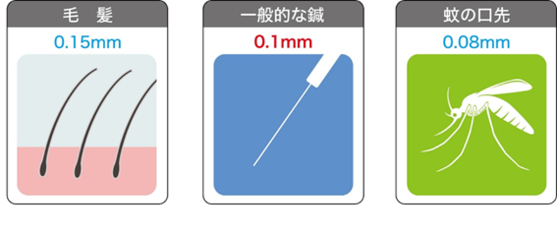 電気針を受ける前に知っておくべきQ&A