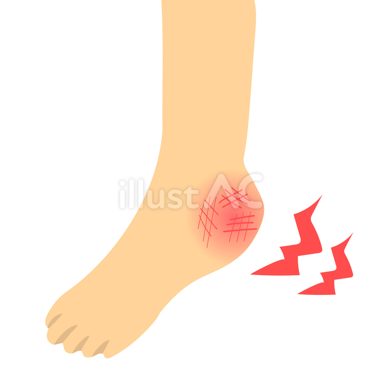 小学生のかかとが痛む原因とは?(基礎知識)