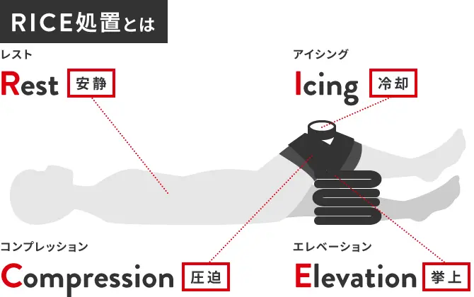 靭帯伸びるのは自然に改善する?回復期間の目安