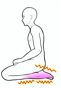 考えられる主な原因(神経・血流・構造など)