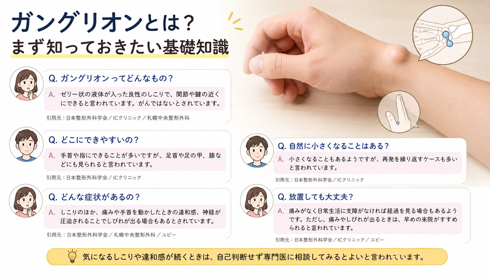 ガングリオンとは?まず知っておきたい基礎知識