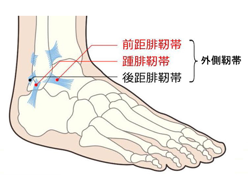 靭帯伸びるとどうなる?主な症状とセルフチェック