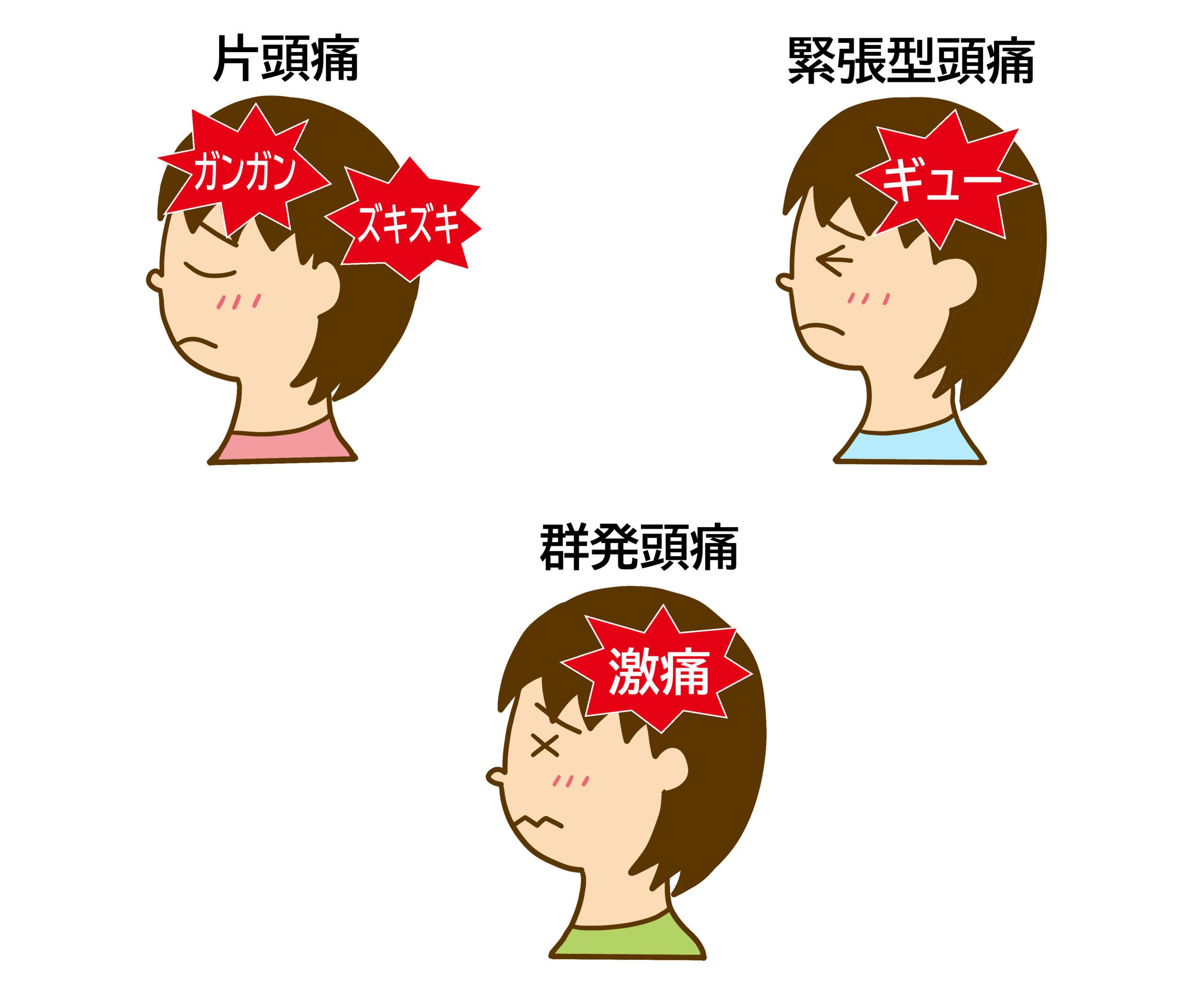 寝過ぎて頭痛いのはなぜ?主な原因と仕組み