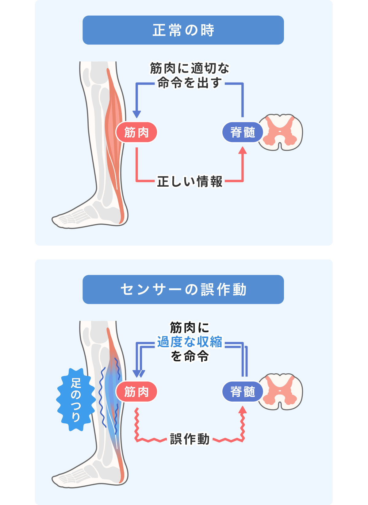 すねがつる原因とは?(なぜ起こるのか)