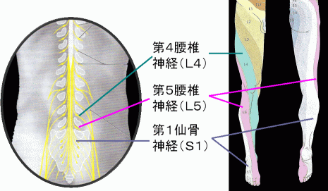腰痛のタイプ別|鍼灸が向いている/向かないケースとは?
