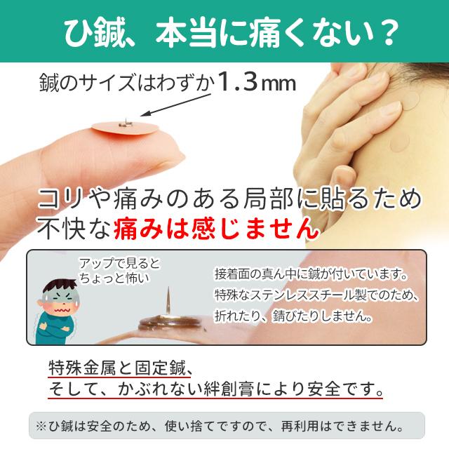 置き針とは？効能が期待される理由