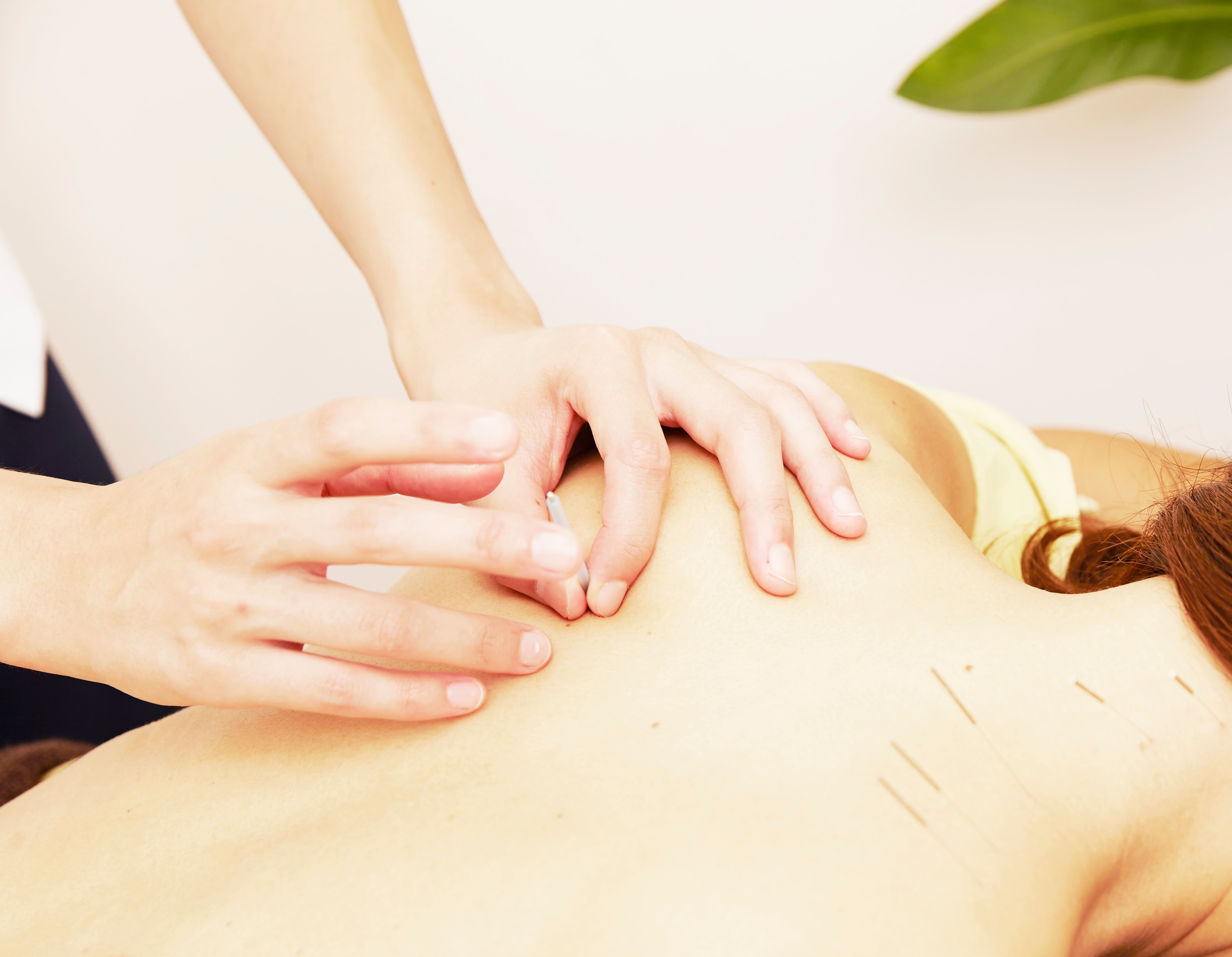 鍼灸は自律神経にどう働く?科学的・東洋医学的なメカニズム