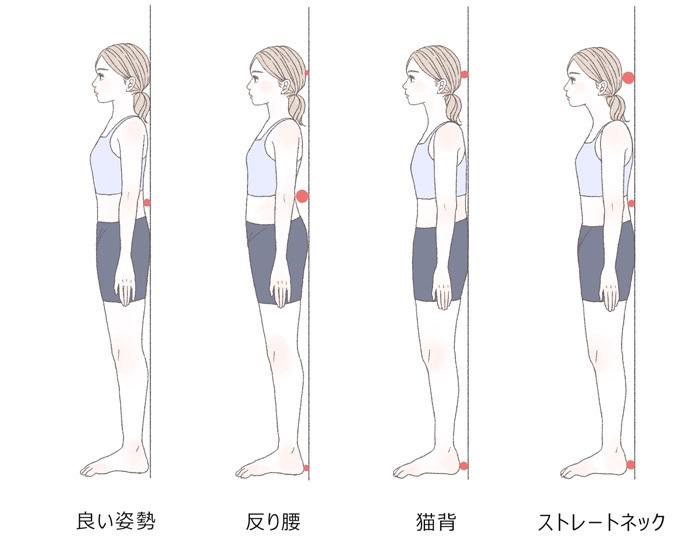 猫背を改善する生活習慣のポイント