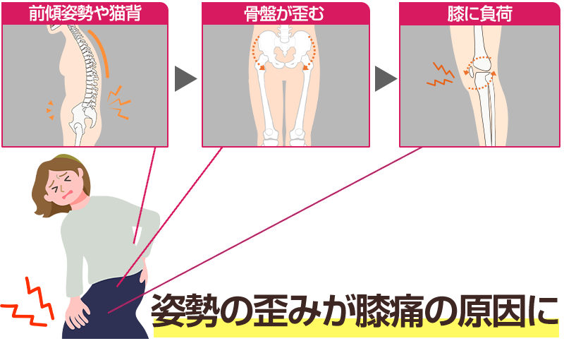 姿勢による膝の痛みイメージ