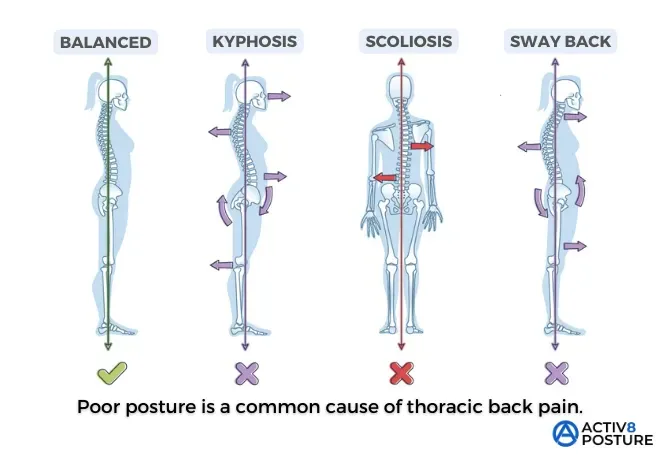 原因別に考える:体を捻ると背中が痛い主なメカニズム