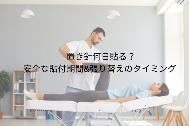 置き針 何日貼る？安全な貼付期間＆貼り換えのタイミング完全ガイド