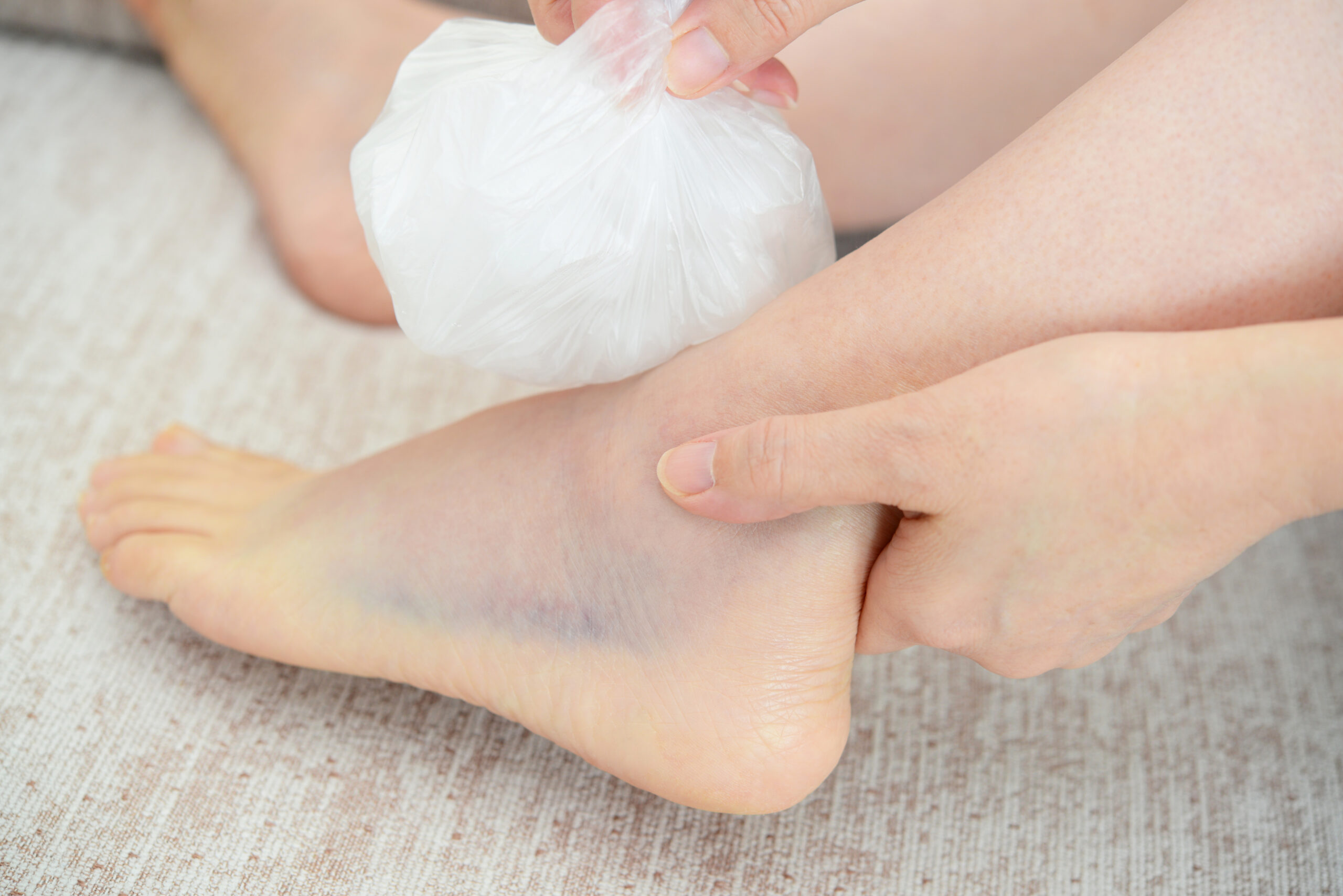 捻挫 歩けるけど痛い 知恵袋|本当に軽症?よくある疑問と専門家の見解