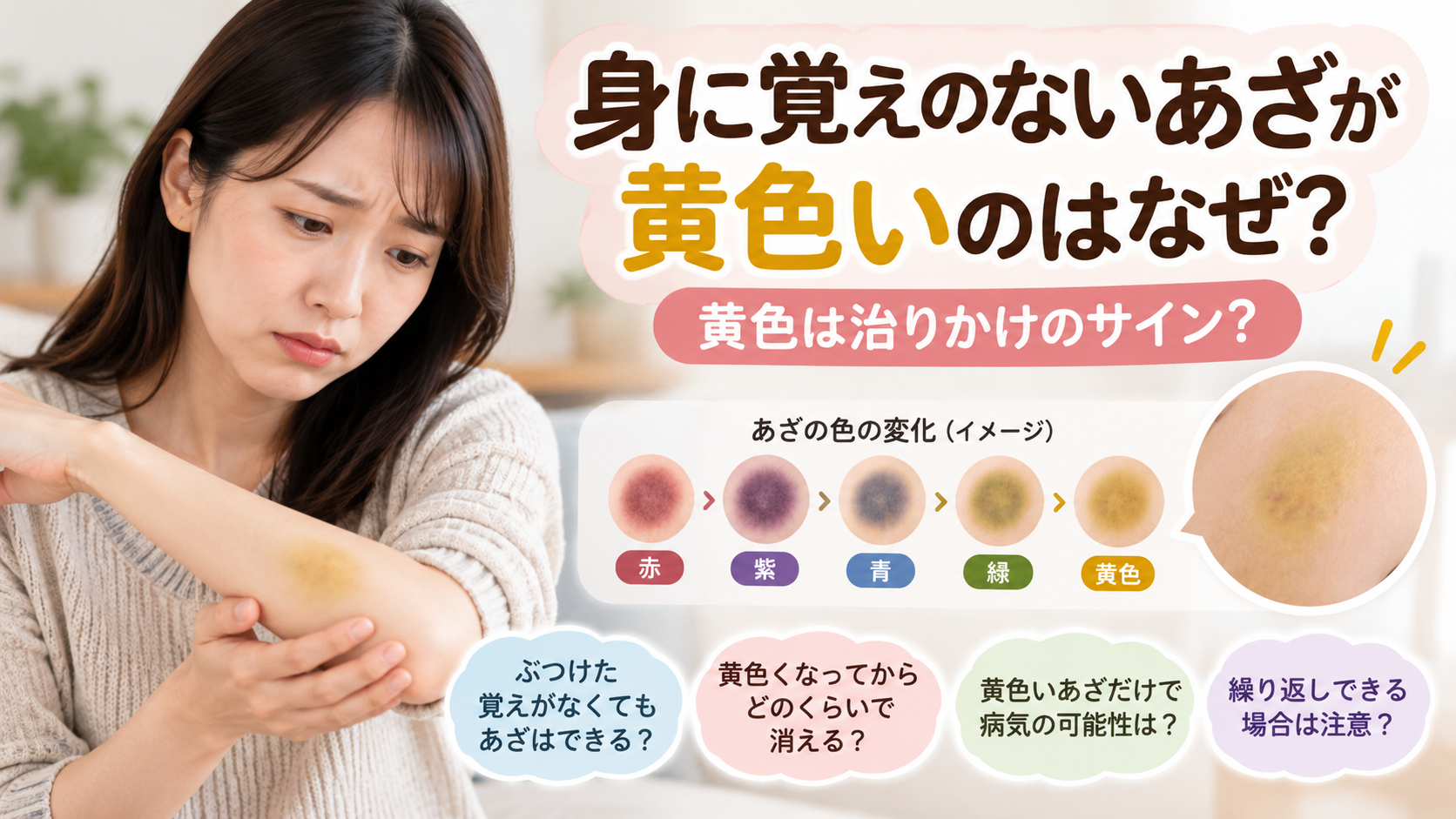 身に覚えのないあざが黄色いのはなぜ?黄色は治りかけのサイン?